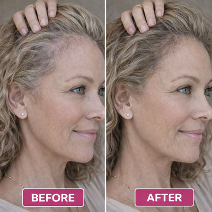 Lazena® Scalp Care Red Light Comb