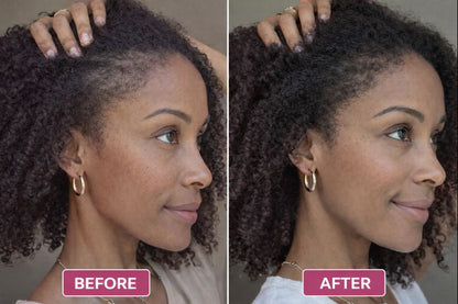 Lazena® Scalp Care Red Light Comb